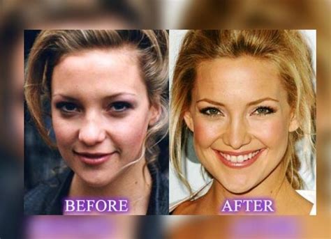 photos of kate hudson|kate hudson current picture.